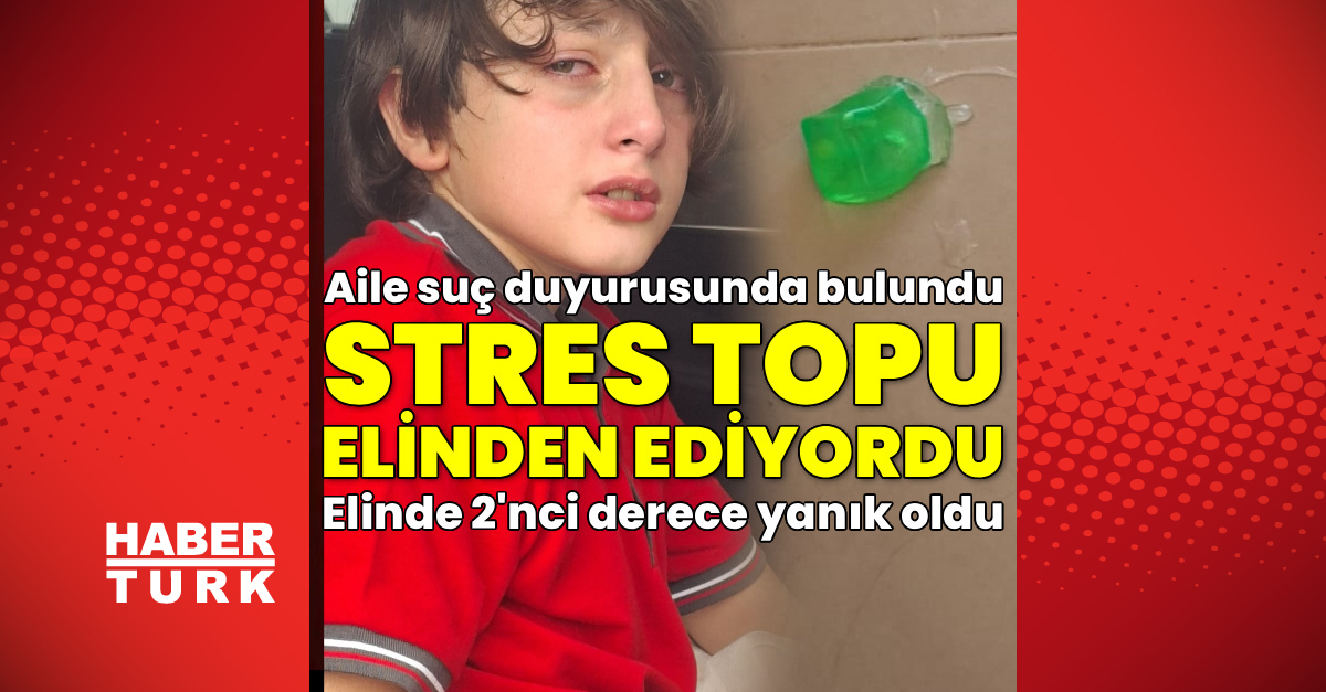 Stres oyuncağı elinde patladı! Yanık ve kızarık gerçekleşti